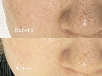 クリアー(CLEAR.)/【Before＆After】