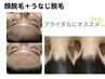 【顔＋うなじ脱毛】綺麗なフェイスラインで全方向から美しい！結婚式前にも◎