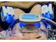 カメリー座薫 大阪上本町本店の写真/夏に向けて美BODYを磨きたい方★[お腹/前or横or裏もも/二の腕/あご下]から選べる冷却痩身*一か所¥3980！