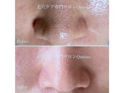 クトナ(Qutona)の写真