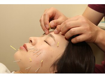 ふなと川接骨院 倉賀野院/美容鍼【群馬　高崎　美容鍼灸】