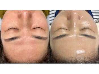 キムズエステティックサロン(Kim's aesthetic salon)の写真/【本場韓国仕込みの本格技！】皮膚美容師オーナーが贈る【極上フェイシャル&ボディ】で肌も心もリセット◇
