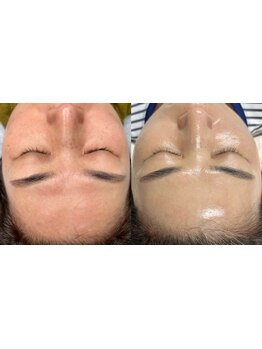 ハンドテクニックにこだわりあり