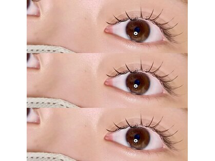 ユラ(Yura)の写真