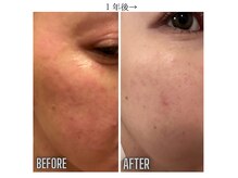 ラポール(rappore;)の雰囲気（無添加化粧品のDr．リセラを使用。肌質改善もお任せください◎）