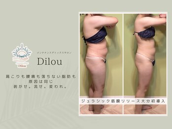 ディーロウ(Dilou)