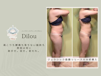 ディーロウ(Dilou)の写真