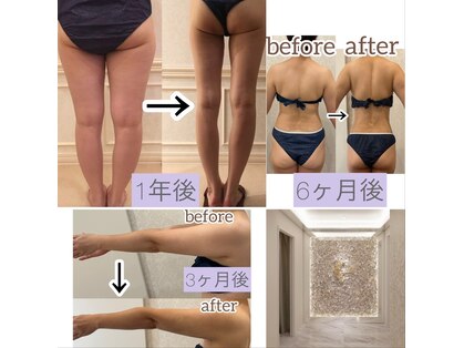 ラルーナ(La Luna)の写真