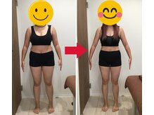 美容整体院元 光の森店/30代M.N様のビフォーアフター