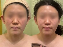 サロンハート(Salon Heart)/