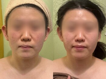 サロンハート(Salon Heart)/