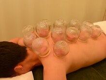 のぞみ整体院 川崎大師店/カッピングでコリをすっきり解消