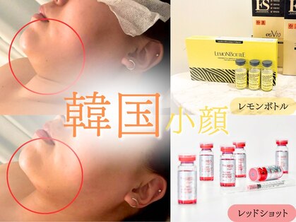 ピナリ(PINARI)の写真