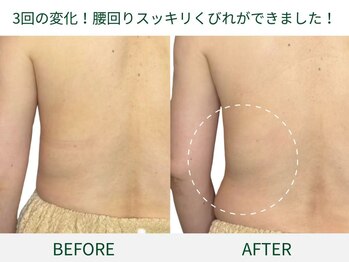 ドクタープラント 北心斎橋店(DR PLANT)/腰まわりスッキリ、くびれ出現！