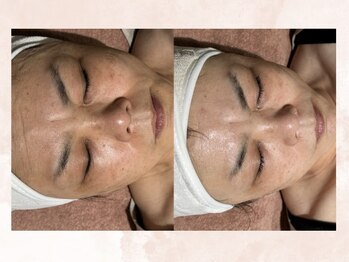 ビジュー(BIJOU)/