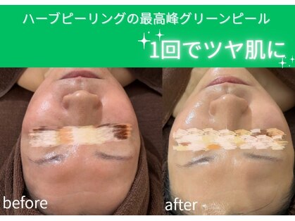 デイジーの写真