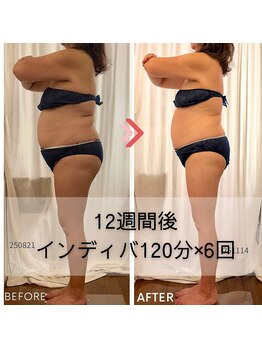 ヒーリングサプリ(Healing Supple)の写真/【温活スリム×ミネラル経皮吸収】カチカチ脂肪を緩めしなやかボディへ。温活で巡りを整えるインディバ痩身