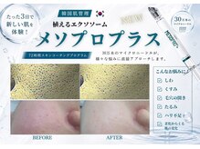ユアーズ ビューティー(YOURS beauty)/メソプロ