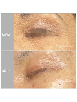 bou 新宿/目元が変われば見た目が変わる!