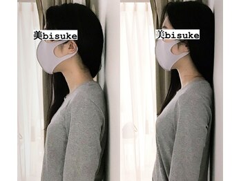 美助(bisuke)/巻き肩ケアのお写真