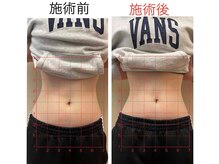 むらた整骨接骨院/EMS　ダイエット