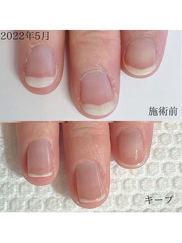 美爪になってきたよ。