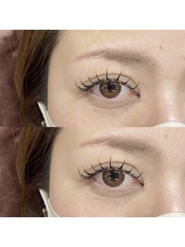 ビュー(V.I.E.W)/BINDLOCK100束