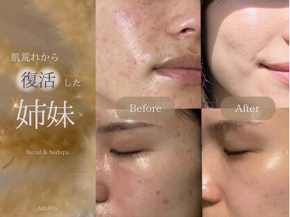 ミーラヤ(MILAYA)の写真