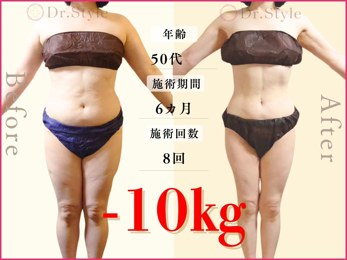 【大幅値下げ】リファインシュール 痩身エステ 第25回美脚部門2位 天神店A・C様｜痩身エステのオリエンタル