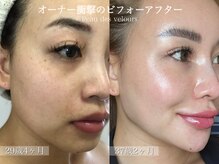 ポーデベロア(Peau des velours)