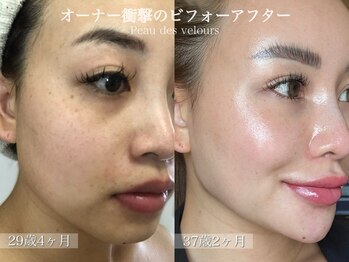 ポーデベロア(Peau des velours)