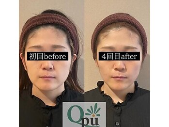 キュープ 鹿児島伊集院店(Qpu)/