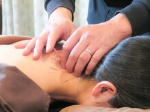 湯川整体院 本院/自律神経が整う鍼灸