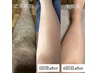 【メンズ足全体】ハーフパンツ映えするツルすべ脚へ★13,000円
