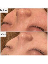 メナードフェイシャルサロン 岐阜茜部/クリーンパック