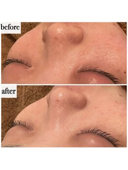 メナードフェイシャルサロン 岐阜茜部/クリーンパック