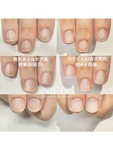 ニコプラス(NICO+)/自爪育成中