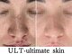 ウルト アルティメイトスキン(ULT ultimate skin)の写真