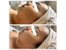 エナッシュビューティサロン(ENASH)の雰囲気（くすんだお顔が１回で、パッと明るい印象に！！光フェイシャル）