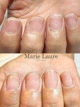マリーロール 梅田店(Marie Laure)/深爪矯正/自爪育成/ネイルケア
