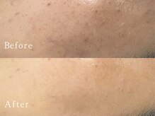 クリアー(CLEAR.)/【Before＆After】