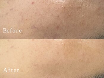 クリアー(CLEAR.)/【Before＆After】