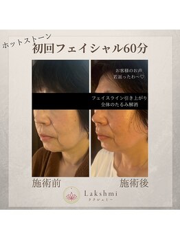 ラクシュミー(Lakshmi)/