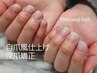 【爪のお悩み解決】深爪矯正ベーシック¥12,000