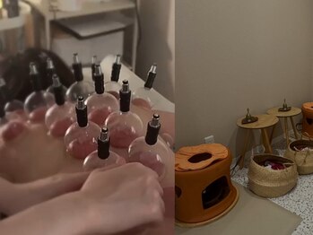 ロレゾールの写真/【よもぎ蒸し＋カッピング7500円】むくみ/冷えなどが気になる方必見◎深部まで解す！！