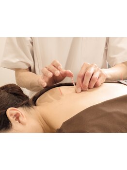 鍼灸施術を受けたい