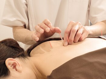 オリエントエクスプレスの写真/【鍼灸75分¥6,800~】首肩こり/腰痛/頭痛/眼精疲労/不眠/自律神経の乱れに◎ ★鍼灸が初めての方にも◎