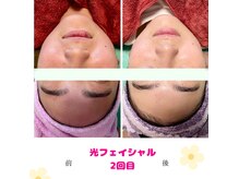 CBDサロン ローズ(ROSE)