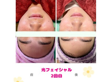 CBDサロン ローズ(ROSE)の写真