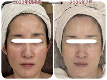 ピエルクララ(Piel clara)